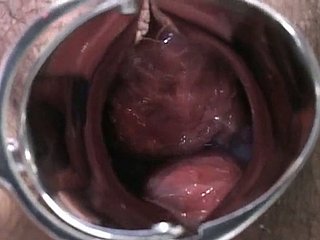 Senhora grávida japonês é examinado e suga lollicock conclude médico